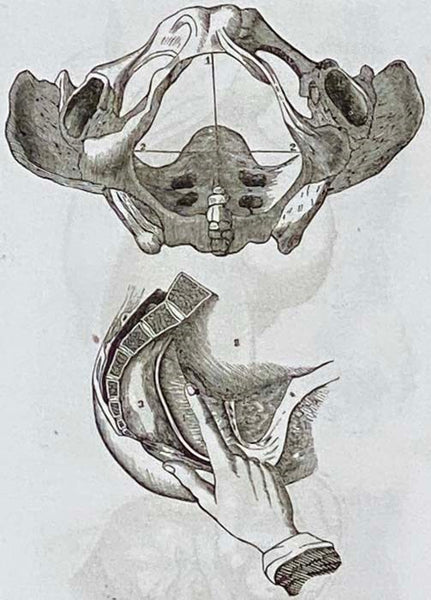 A Treatise on the Domestic Practice of Medicine, Embracing the Most Essential Diseases, Including Those of Women and Children, and Surgery, So Arranged as to Make It of Interest to Physicians, Students of Medicine, and a Domestic Practice for Families.