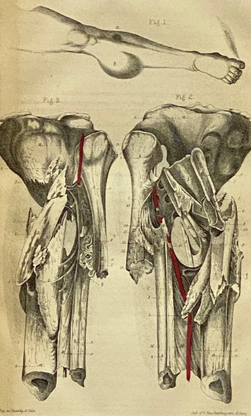 Transactions of the Medical Society of the State of New York, for the Year 1861.