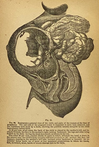 The Practical Home Doctor for Women and Children, to which is added a Valuable Appendix, Containing a List of Medicinal Herbs and Their Value, with Chapters Explaining Poisons and Their Antidotes, How to Resuscitate the Drowned, How to Proceed in Cases o…