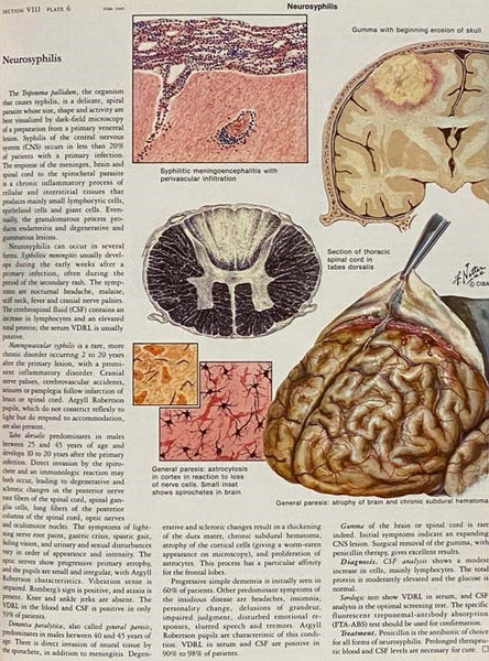 The Ciba Collection of Medical Illustrations, in Two Volumes: Volume 1. Nervous System, in II Parts: Part I. Anatomy and Physiology; Part II. Neurological and Neuromuscular Disorders