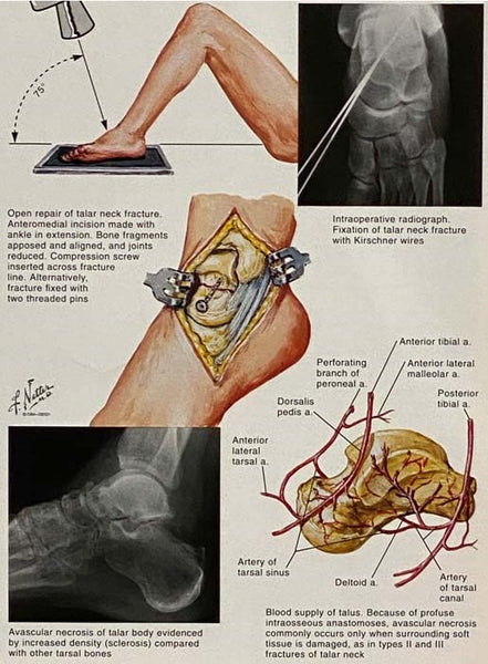 The Ciba Collection of Medical Illustrations, Volume 8: Musculoskeletal System, Part III: Trauma, Evaluation, and Managment