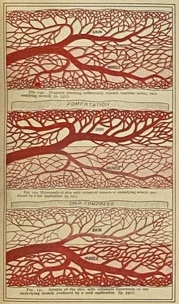 Rational Hydrotherapy: A Manual of the Physiological and Therapeutic Effects of Hydriatic Procedures, and the Technique of Their Application in the Treatment of Disease