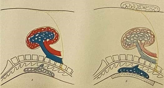 Rational Hydrotherapy: A Manual of the Physiological and Therapeutic Effects of Hydriatic Procedures, and the Technique of Their Application in the Treatment of Disease