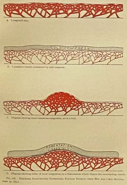 Rational Hydrotherapy: A Manual of the Physiological and Therapeutic Effects of Hydriatic Procedures, and the Technique of Their Application in the Treatment of Disease