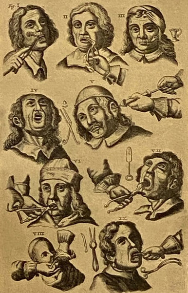 A History of Dentistry from the Most Ancient Times until the End of the Eighteenth Century