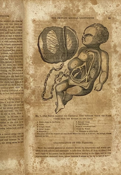 The People's Medical Lighthouse; A Series of Popular and Scientific Essays on the Nature, Uses, and Diseases of the Lungs, Heart, Liver, Stomach, Kidneys, Womb and Blood; Also, a Key to the Causes, Prevention, Remedies, and Cure of Pulmonary and Other Ki…