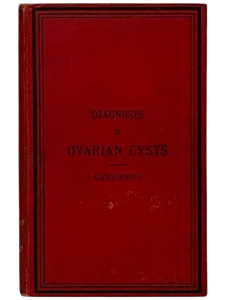 Diagnosis of Ovarian Cysts