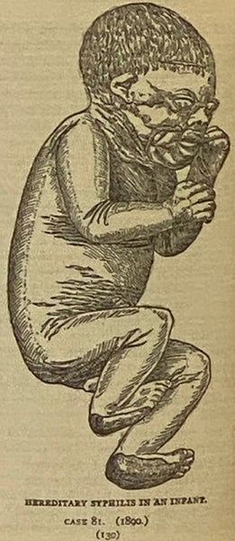Man's Mission on Earth: A Short Treatise on Diseases of the Genito-Urinary Organs and Accompanying Nervous Diseases, with a Chapter on Syphilis